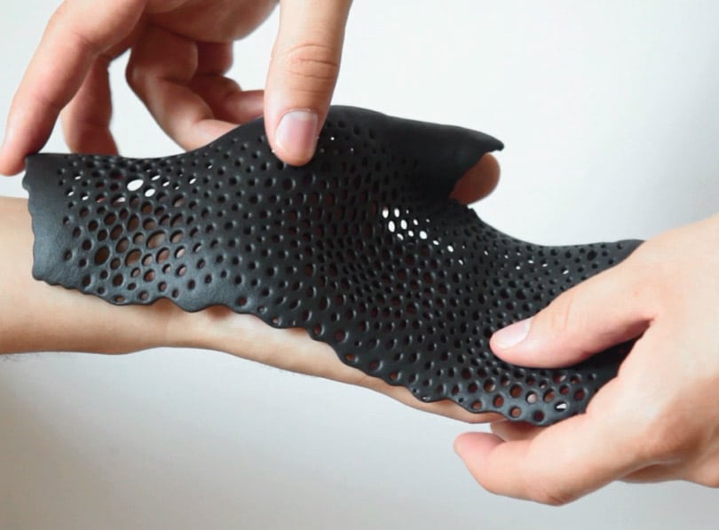Generative and bespoke orthoses