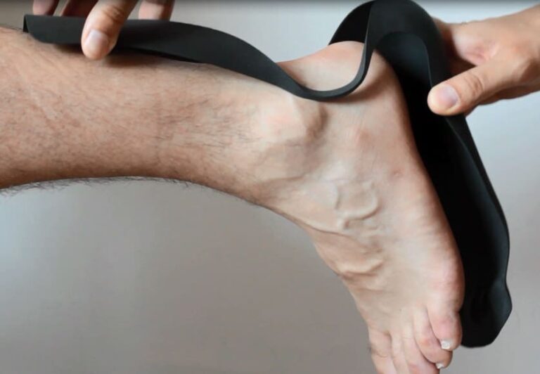 Generative and bespoke orthoses